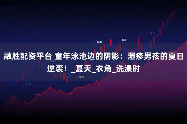 融胜配资平台 童年泳池边的阴影：湿疹男孩的夏日逆袭！_夏天_衣角_洗澡时